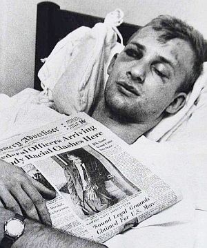 Freedom Rider Jim Swerg in his hospital bed after beating with a copy of the “Montgomery Advertiser” newspaper, with his bloody photo on its front page.
